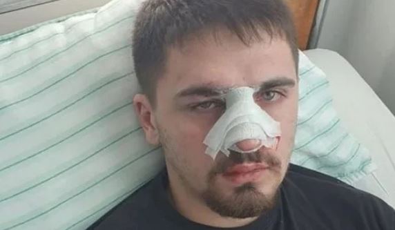 Нови разкрития за скандала с бито 19-г. момче в Плевен и намесените полицай, бащата разкри, че… 18+