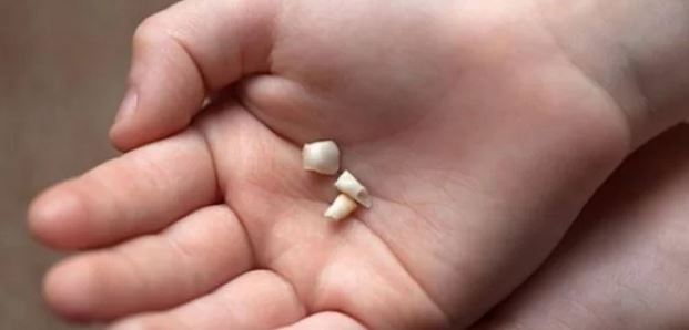 Не хвърляйте бебешките зъби! Един ден те могат да спасят живота ви!