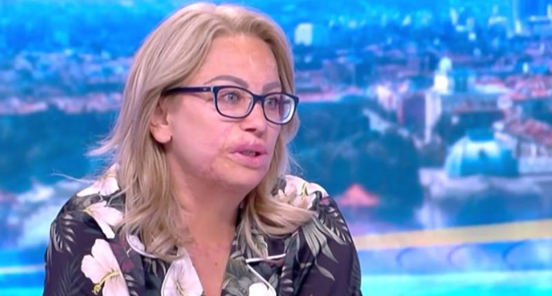Залятата с киселина Мария Бонева: Дойдох без грим, за да отправя послание към момичето с 400 шева