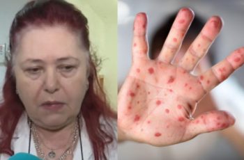 Бяла Слатина под карантина, ситуацията с морбили излиза извън контрол!